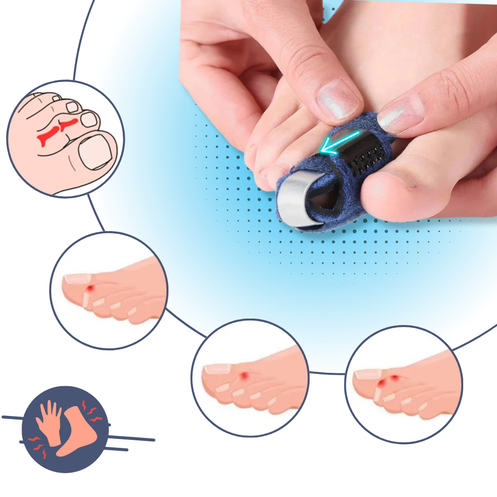 Redresseur d'orteils ajustable et discret - Ozerty