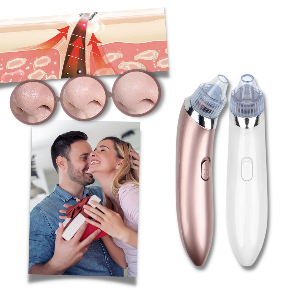 Aspirateur de points noirs du visage - Ozerty