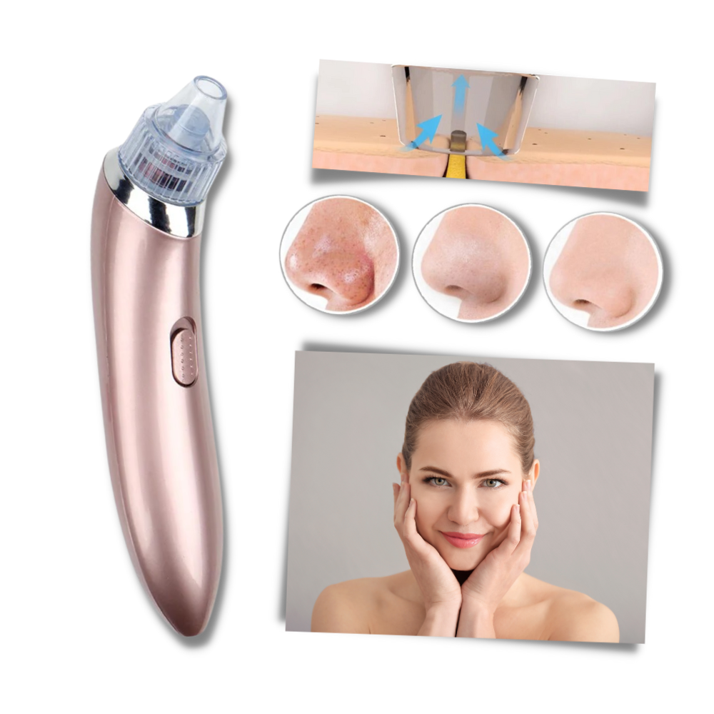 Aspirateur de points noirs du visage - Ozerty
