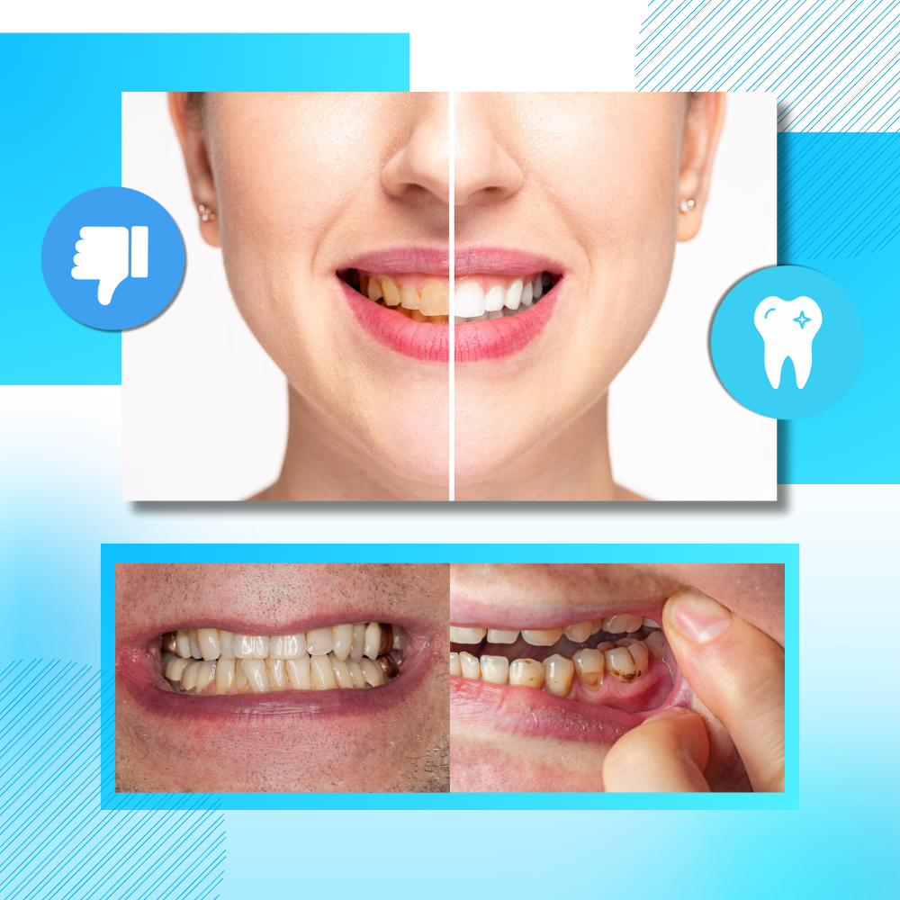 Bandes de blanchiment des dents au charbon et à la menthe - Ozerty