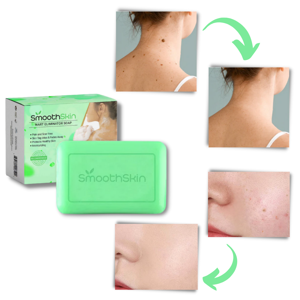 Savon exfoliant hydratant contre les verrues
- Ozerty