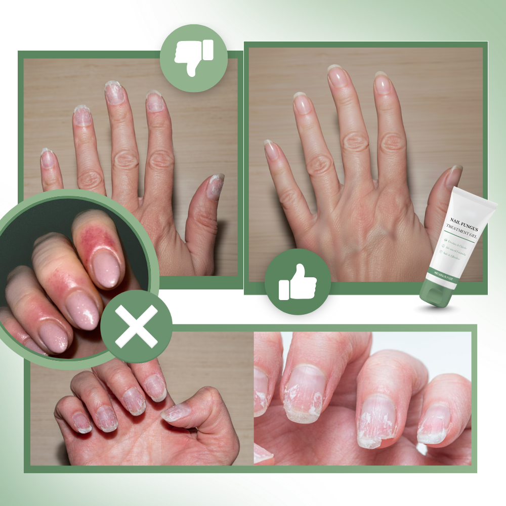 Gel fortifiant et hydratant pour les ongles - Ozerty