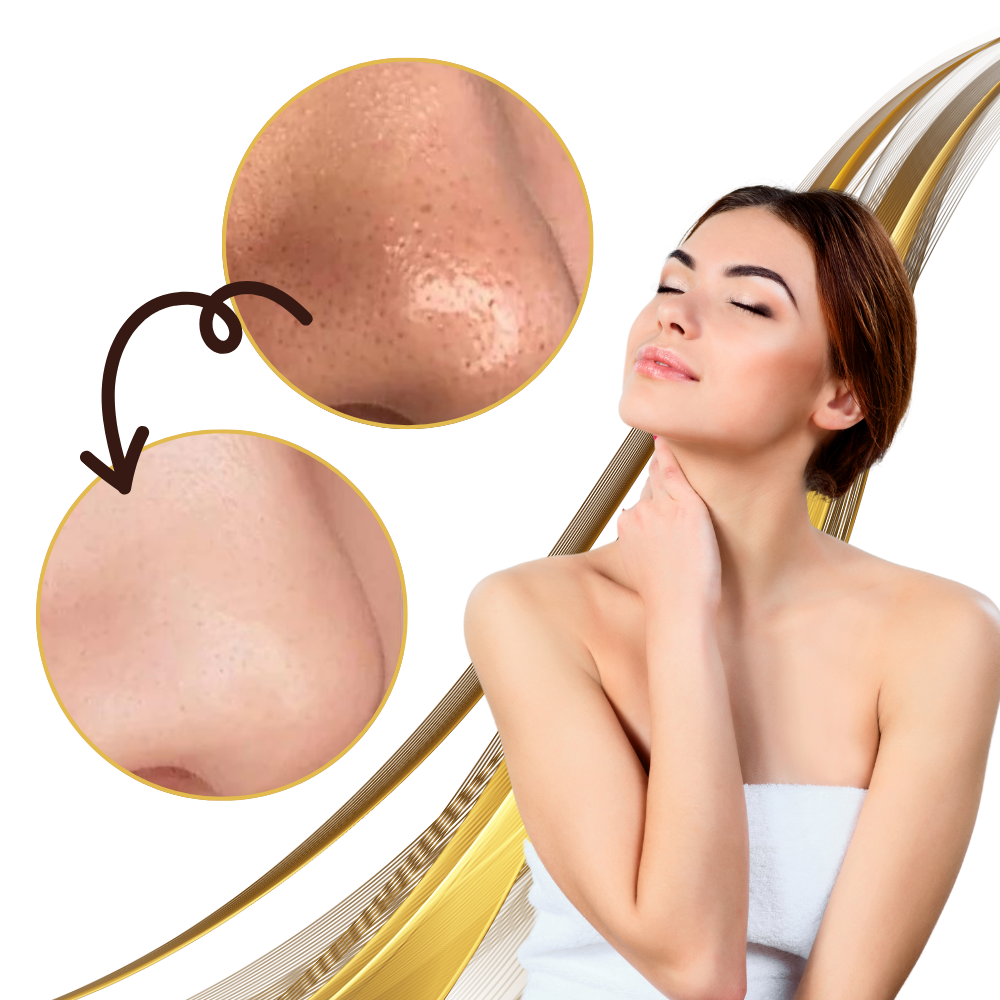 Masque doré peel-off pour le nettoyage des pores
 - Ozerty