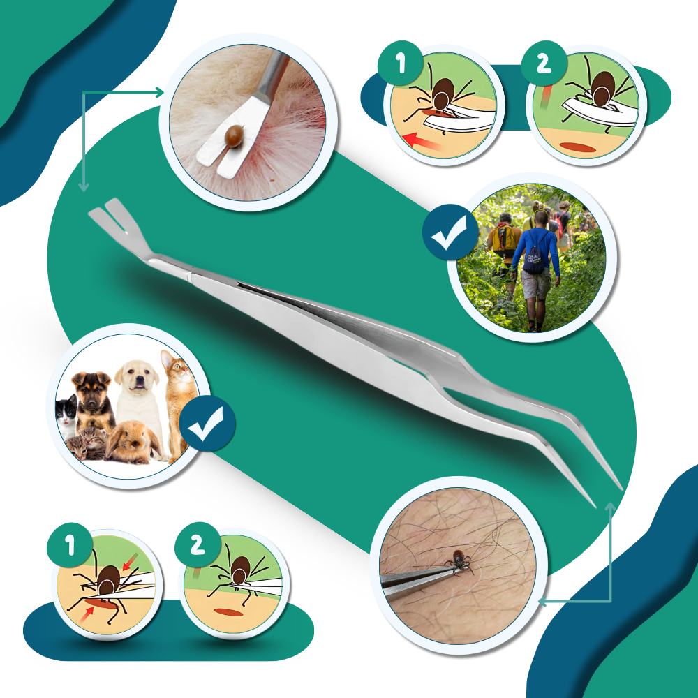 Pince à Tiques De Précision - Ozerty