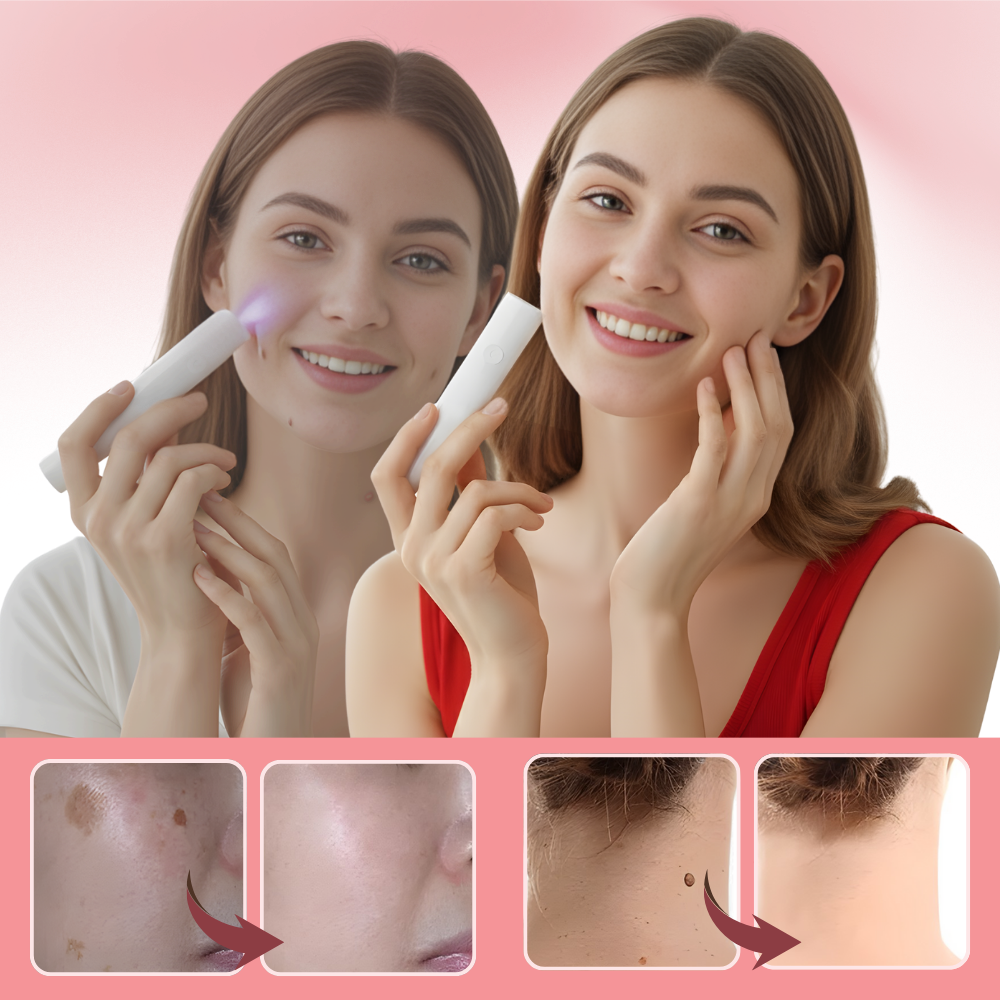 Stylo laser cosmétique Radiance - Ozerty