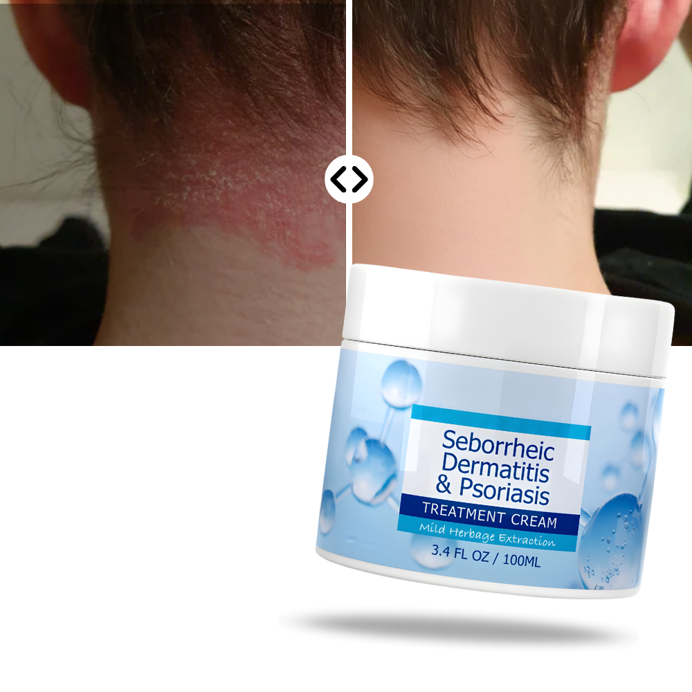 Crème hydratante pour le cuir chevelu - Ozerty