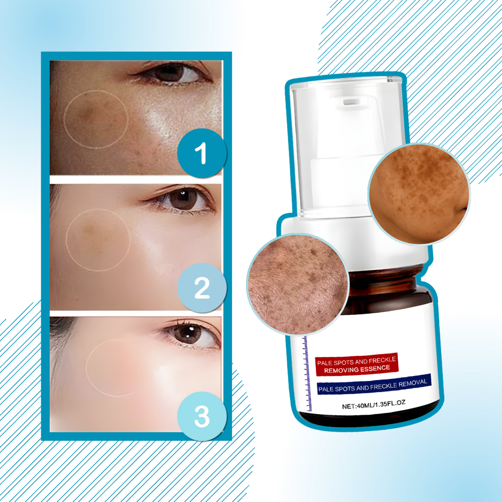 Sérum éclaircissant à l'acide kojique - Ozerty