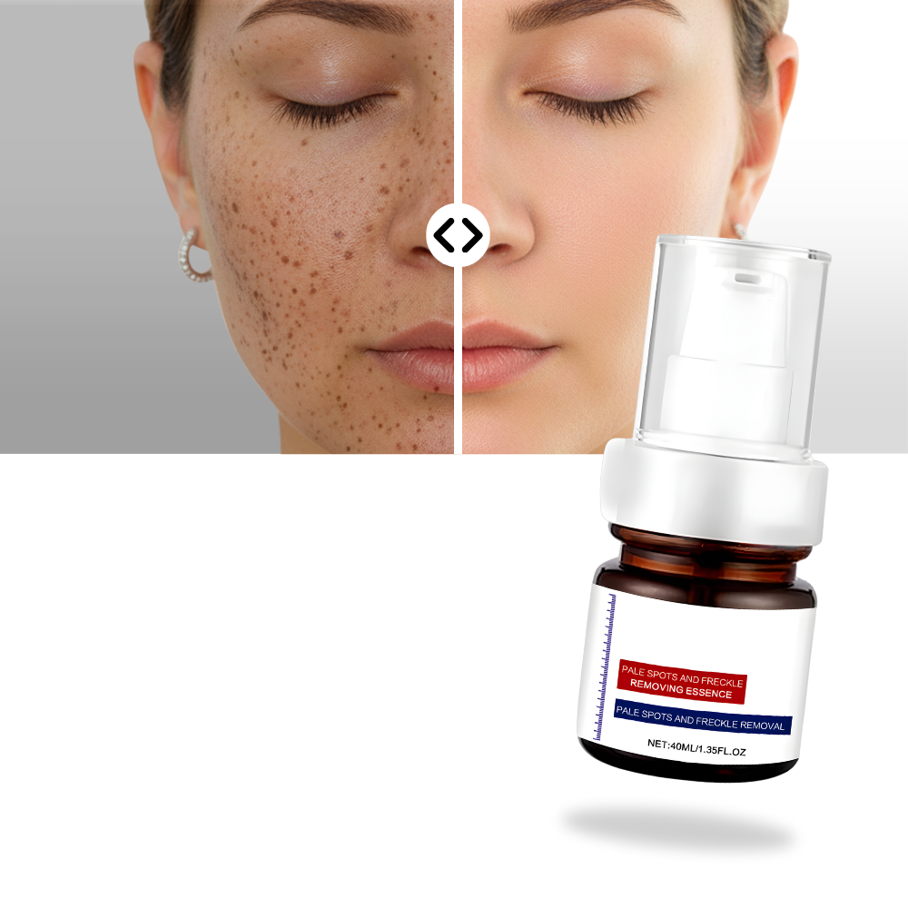 Sérum éclaircissant à l'acide kojique - Ozerty