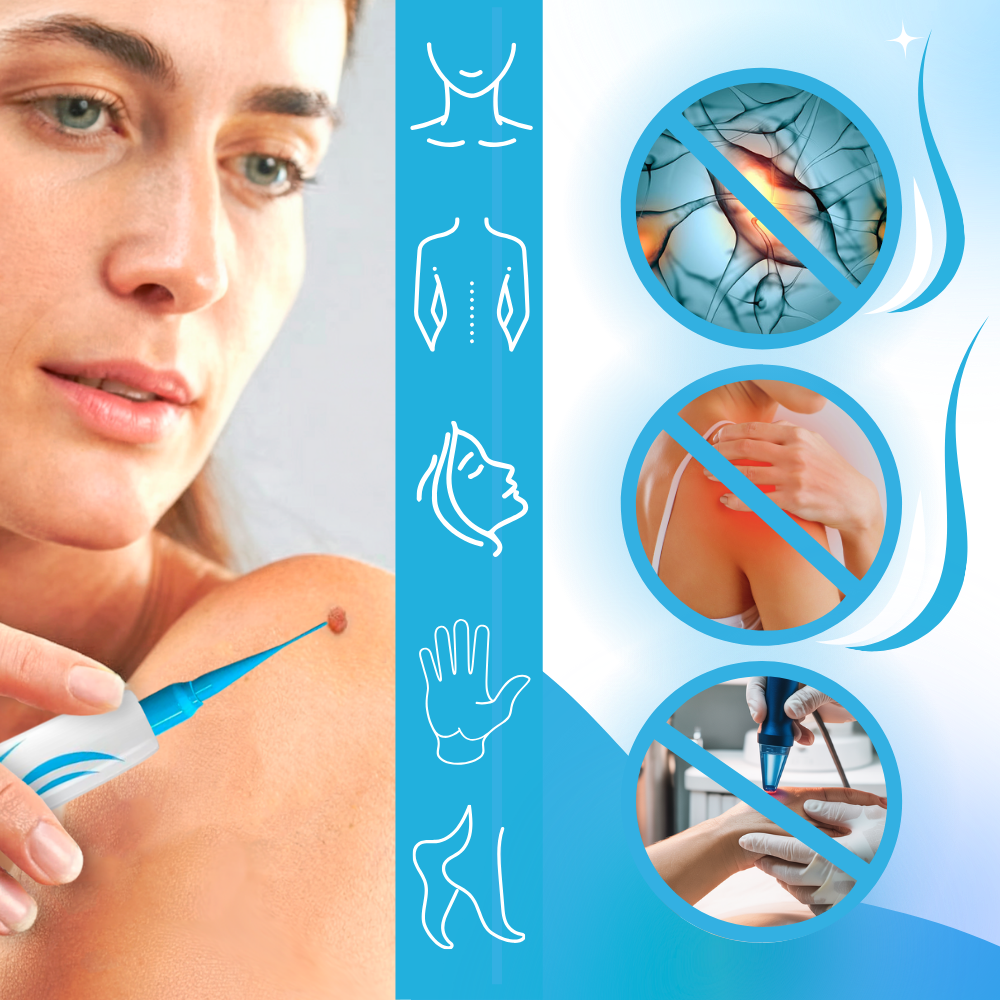 Kit de Traitement Pro des Acrochordons - Ozerty