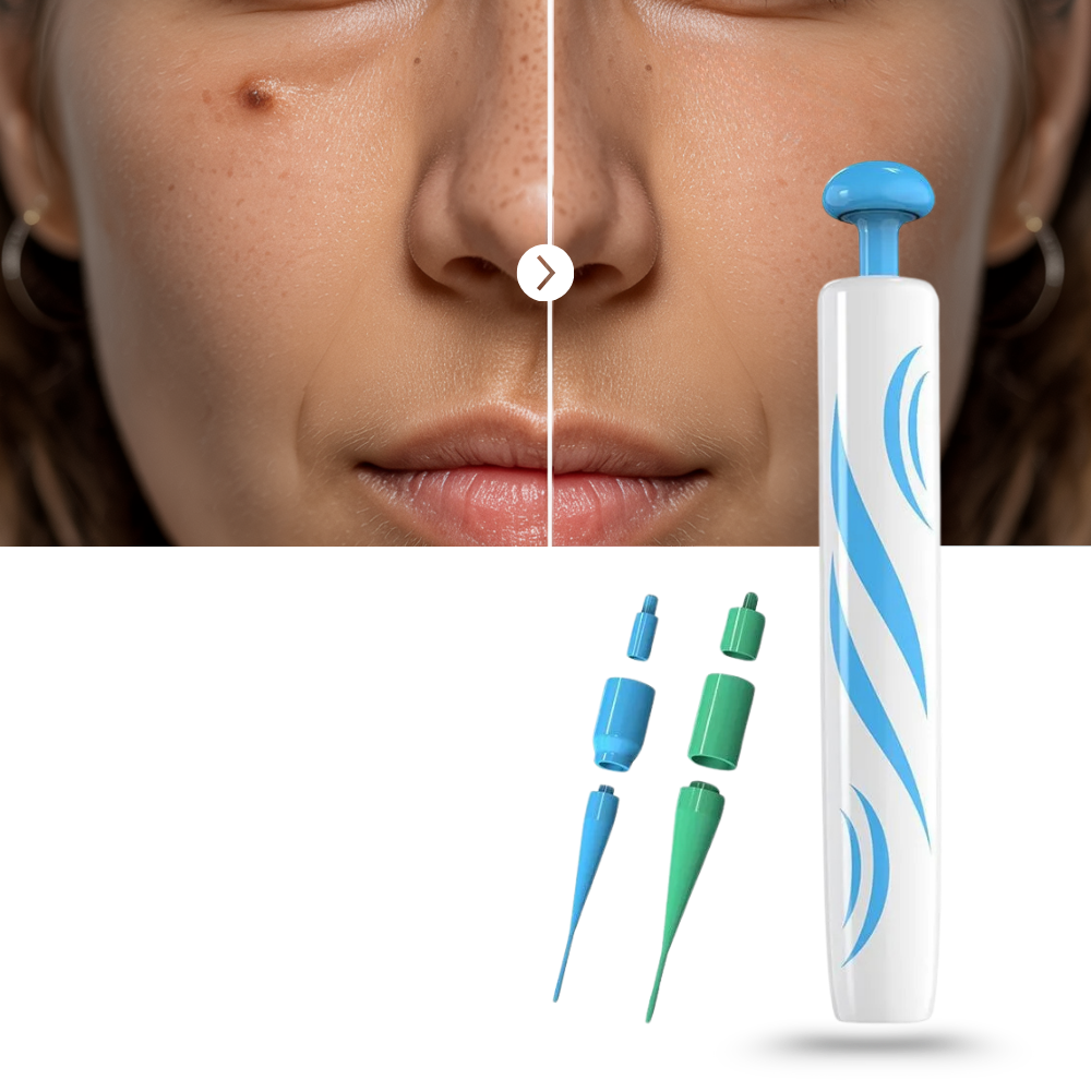 Kit de Traitement Pro des Acrochordons - Ozerty