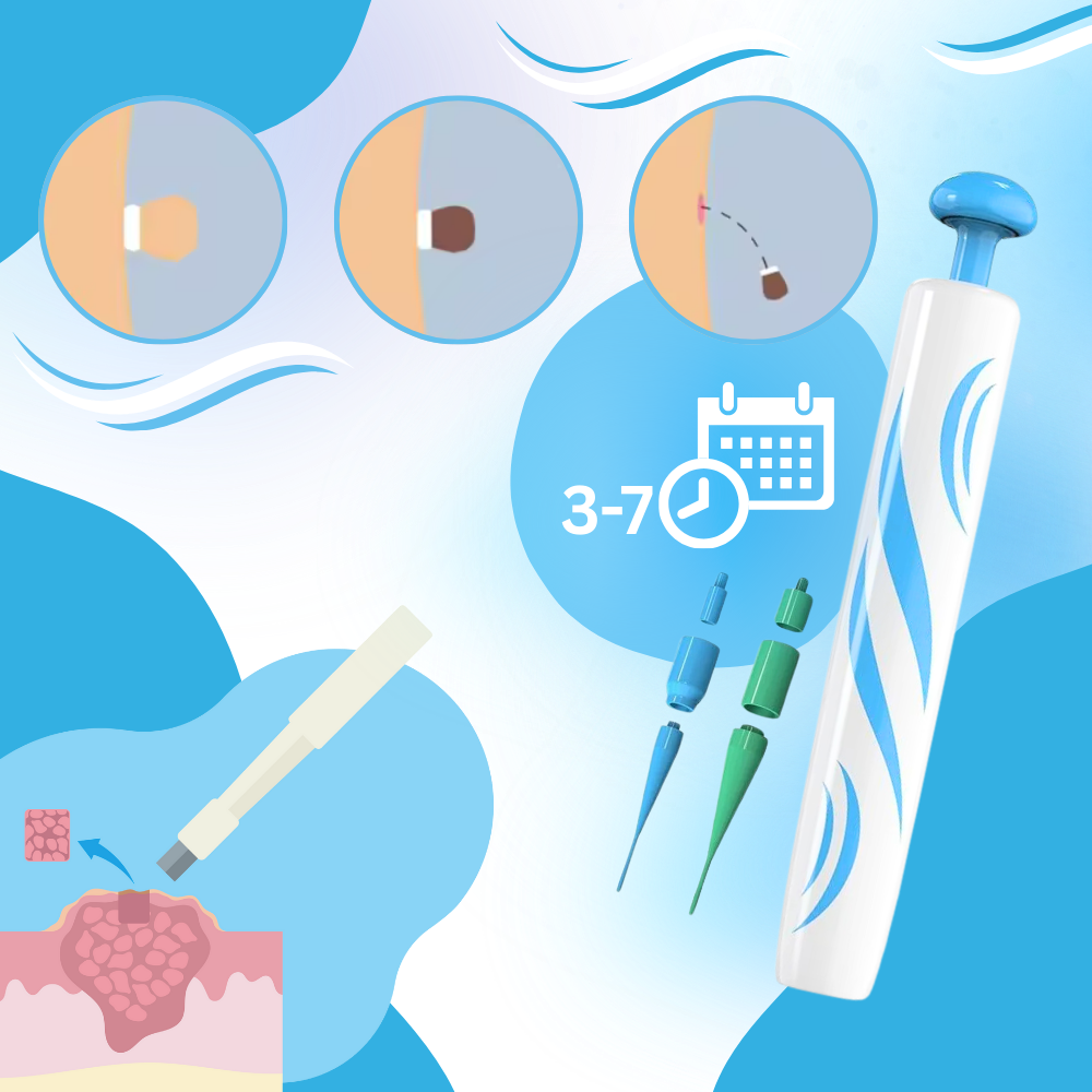 Kit de Traitement Pro des Acrochordons - Ozerty