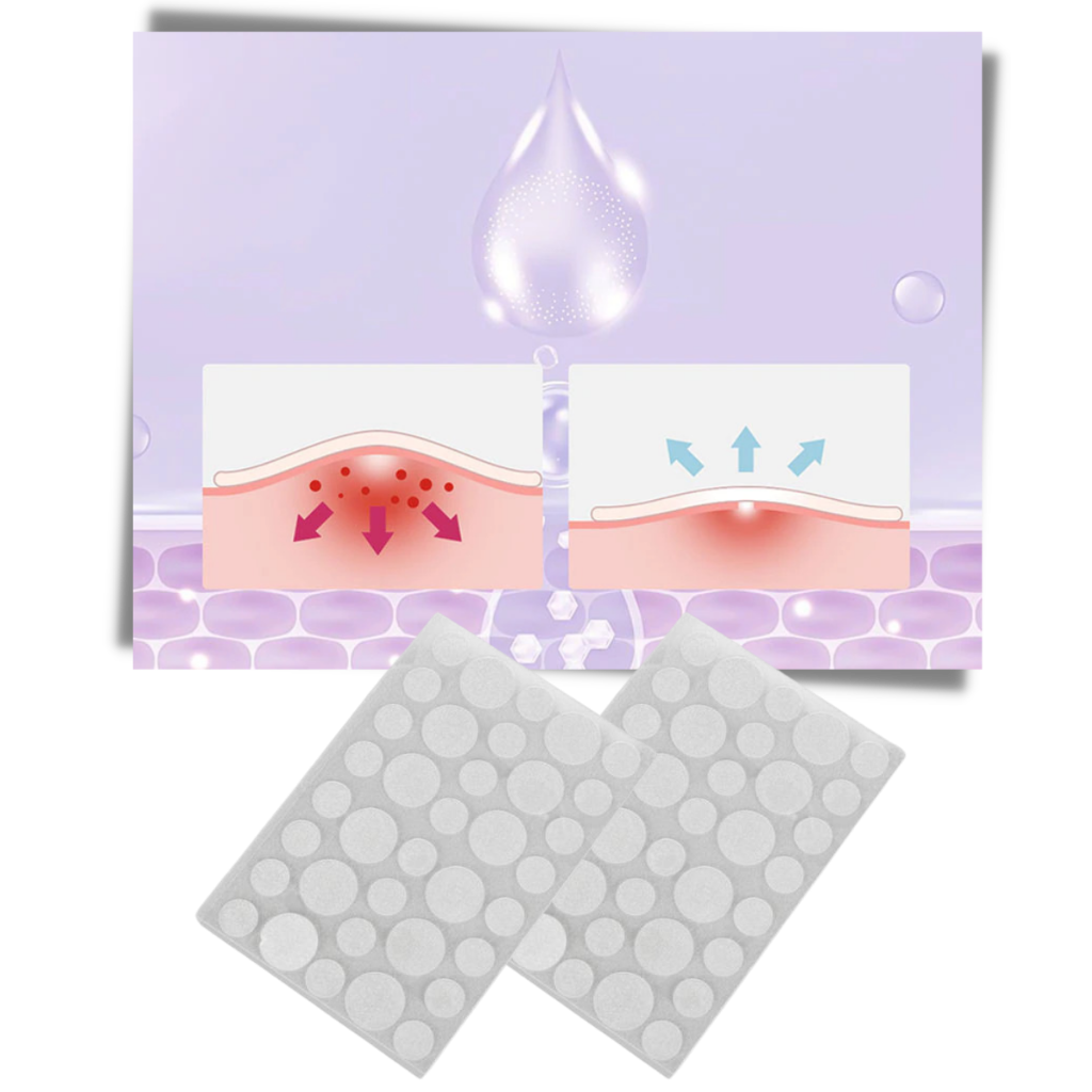 Pack de 36 patchs invisibles contre l'acné - Ozerty