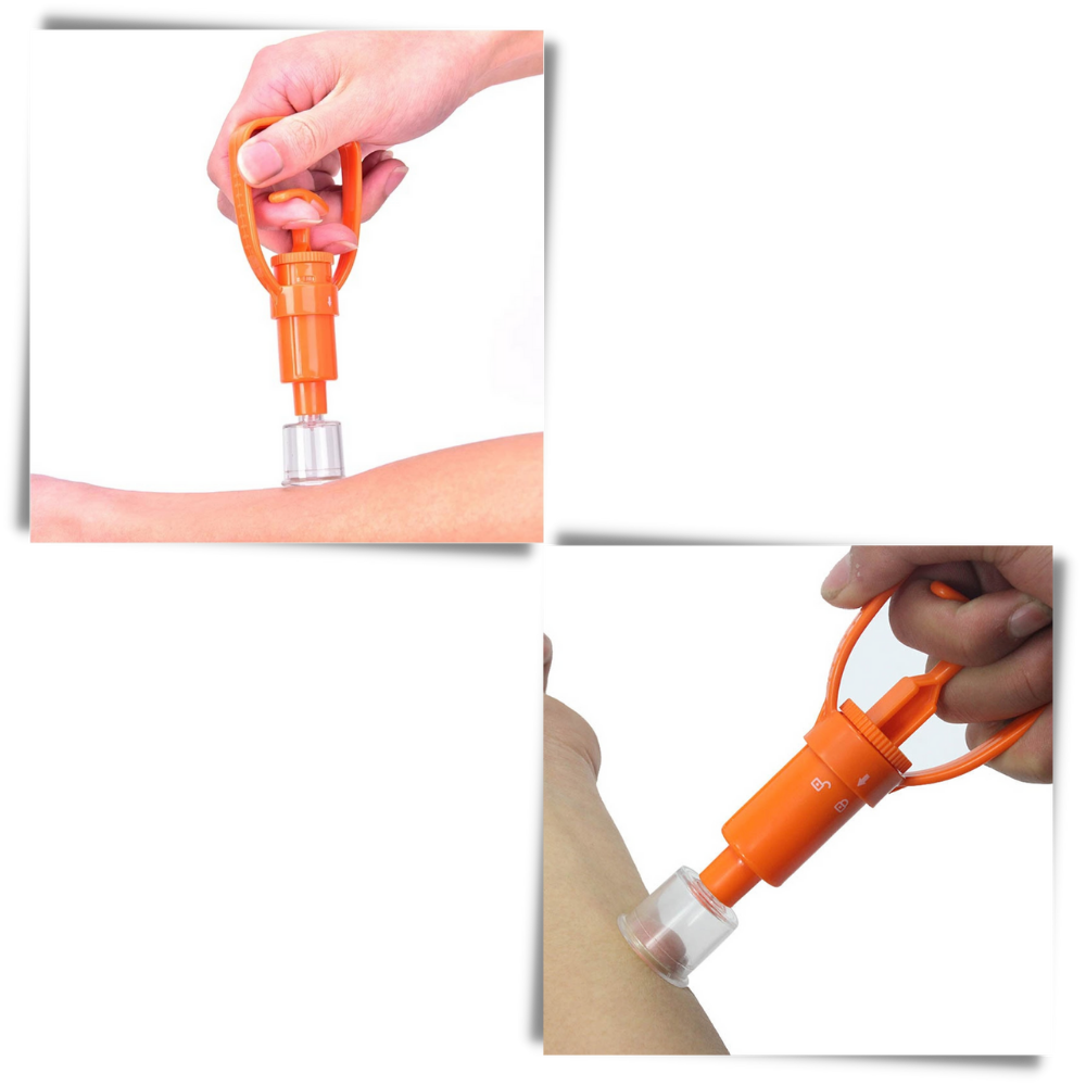 Kit d'extraction d'urgence de venin - Ozerty