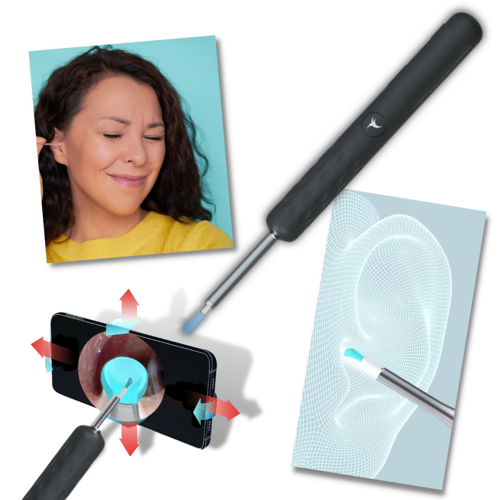 Nettoyant Oreille Adulte Reyova Oreille, Endoscope Nettoyant Oreille Kit Avec 6 Lumières Led, Otoscope Oreille 1080p Hd, Pour Ios And Android, Pour Adultes, Enfants (Noir Nettoyage Oreille