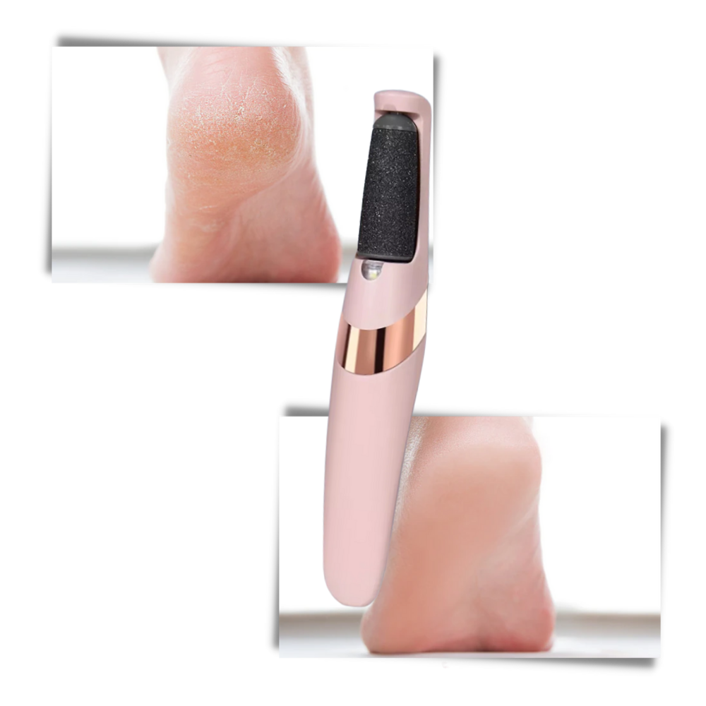 Éliminateur électrique de callosités - Ozerty