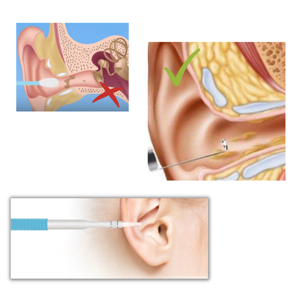 Caméra auriculaire 3 en 1 - Ozerty