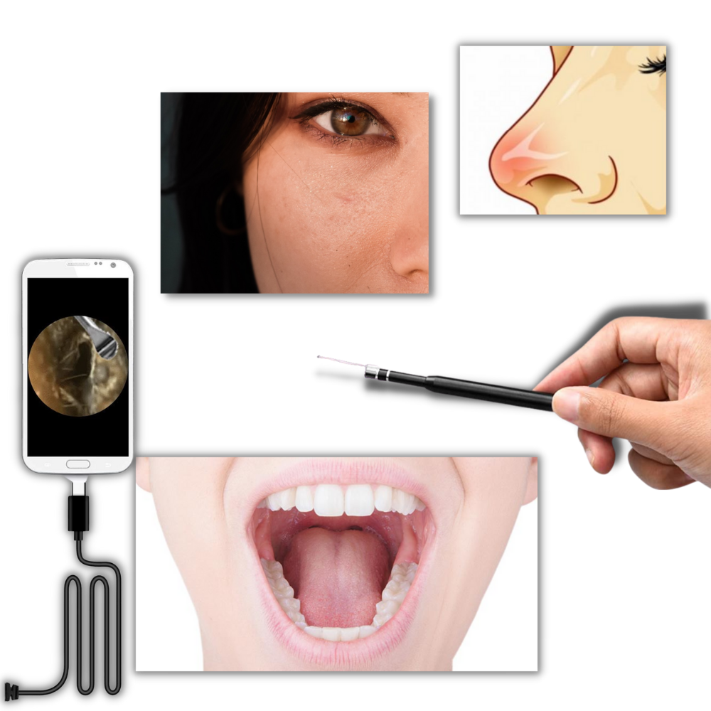 Caméra auriculaire 3 en 1 - Ozerty