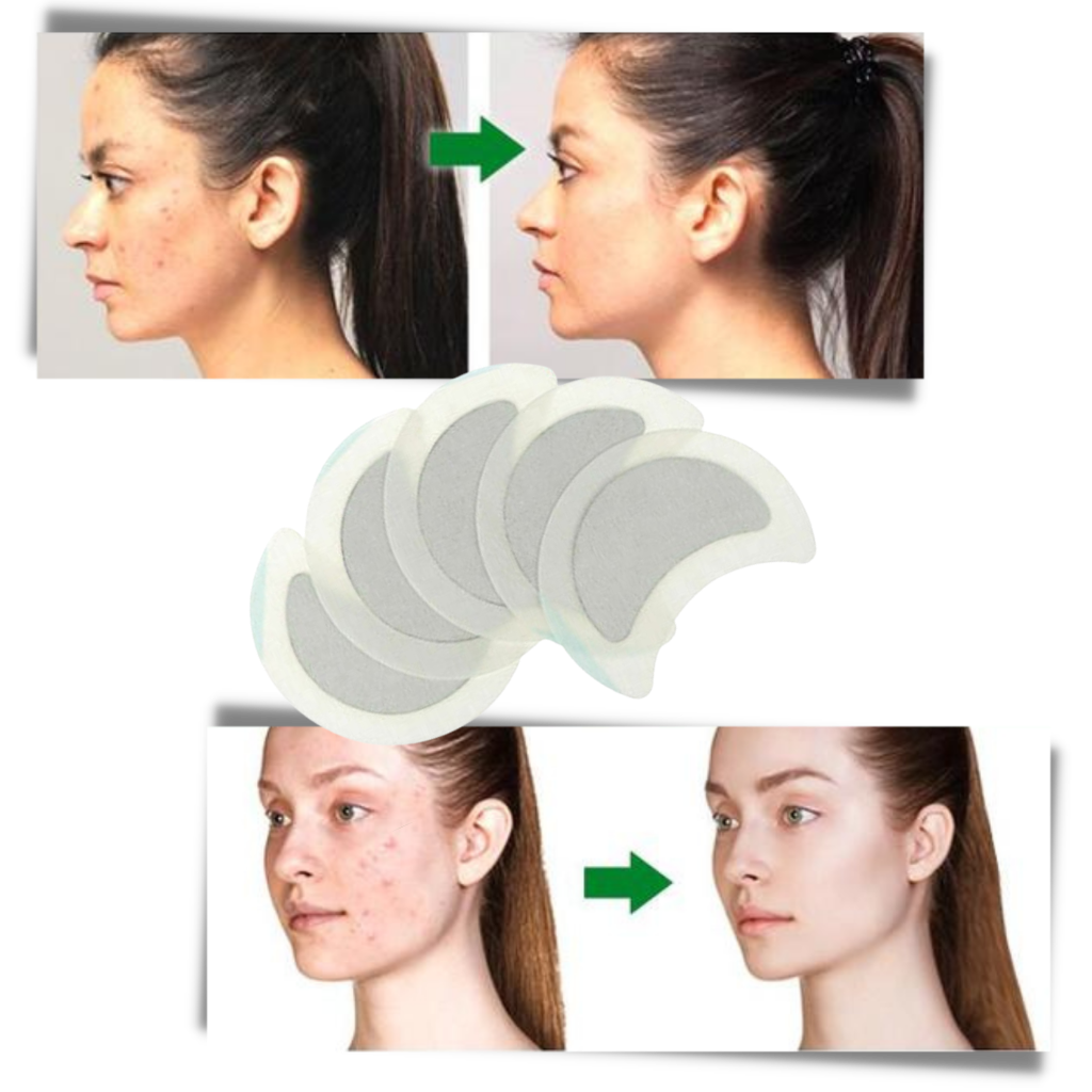 5 Patchs anti-sueur à base de plantes pour les lymphatiques - Ozerty