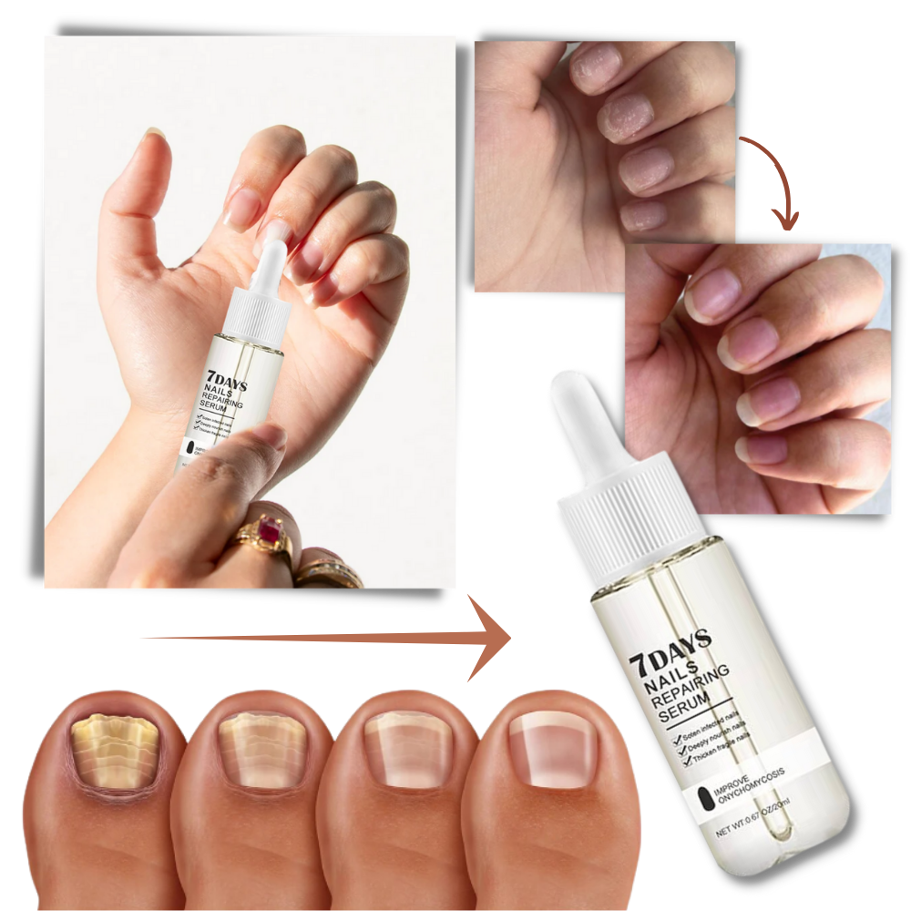 Sérum réparateur pour les ongles en 7 jours - Ozerty