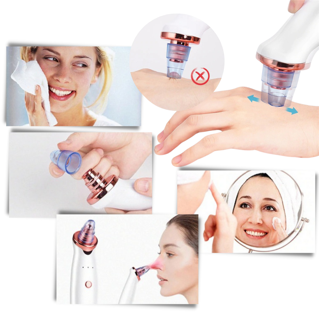 Petit aspirateur pour enlever les points noirs - Ozerty