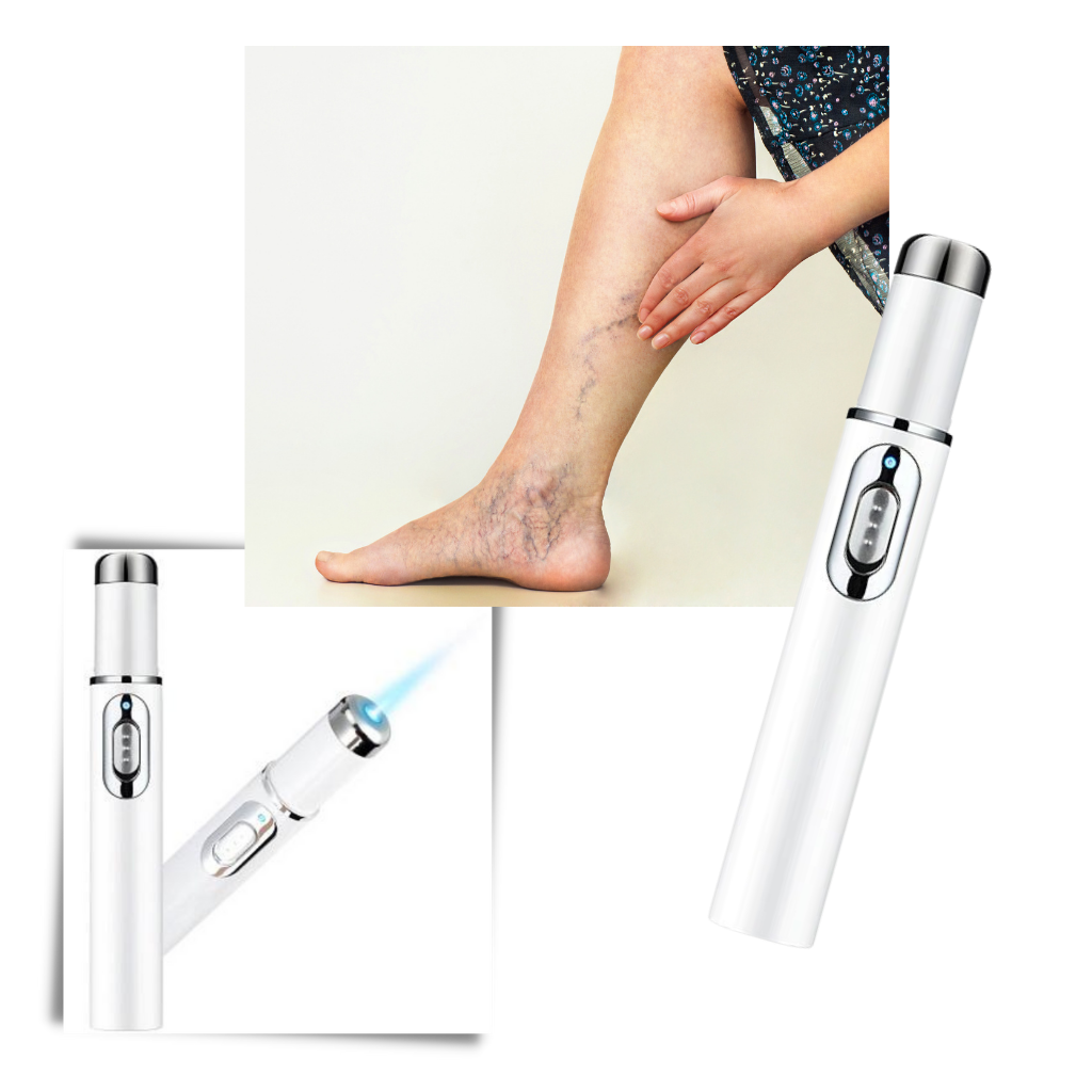 Stylo de thérapie de la peau à la lumière bleue - Ozerty
