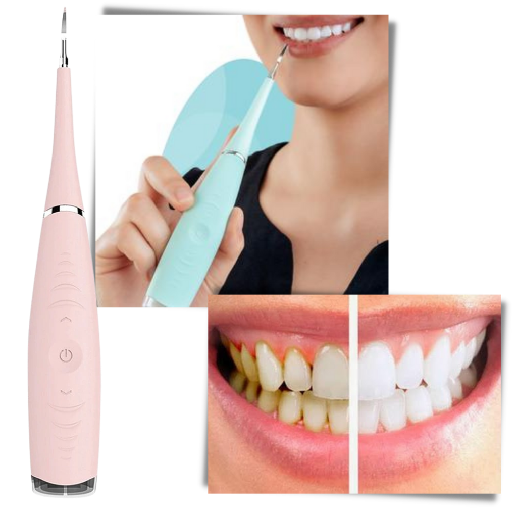 Machine de détartrage dentaire - Ozerty