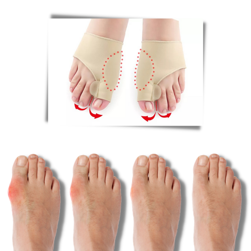 Correcteur d'oignons de pieds en gel - Ozerty