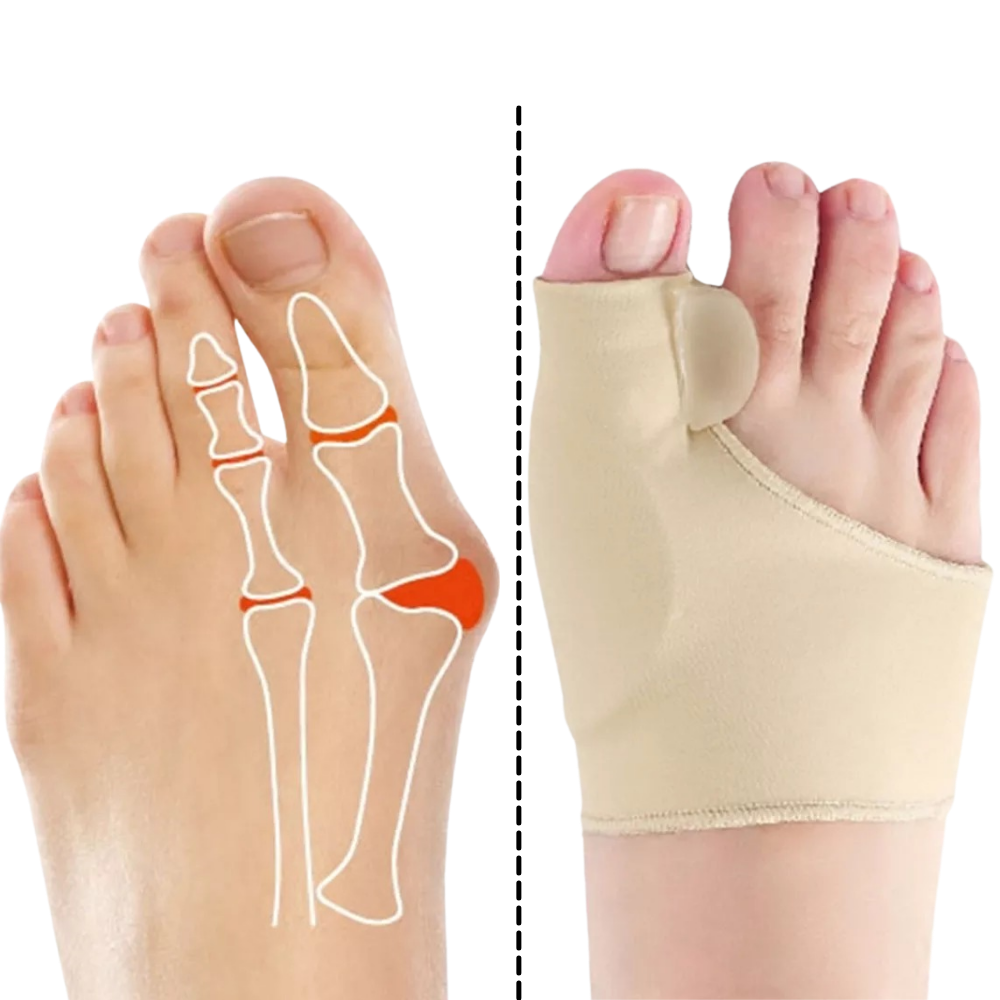 Correcteur d'oignons de pieds en gel - Ozerty