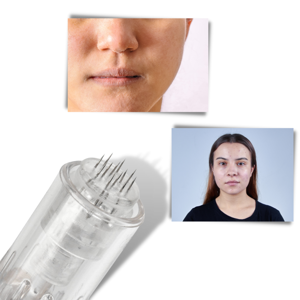 Stylo Dermique de Micro-aiguilletage - Ozerty