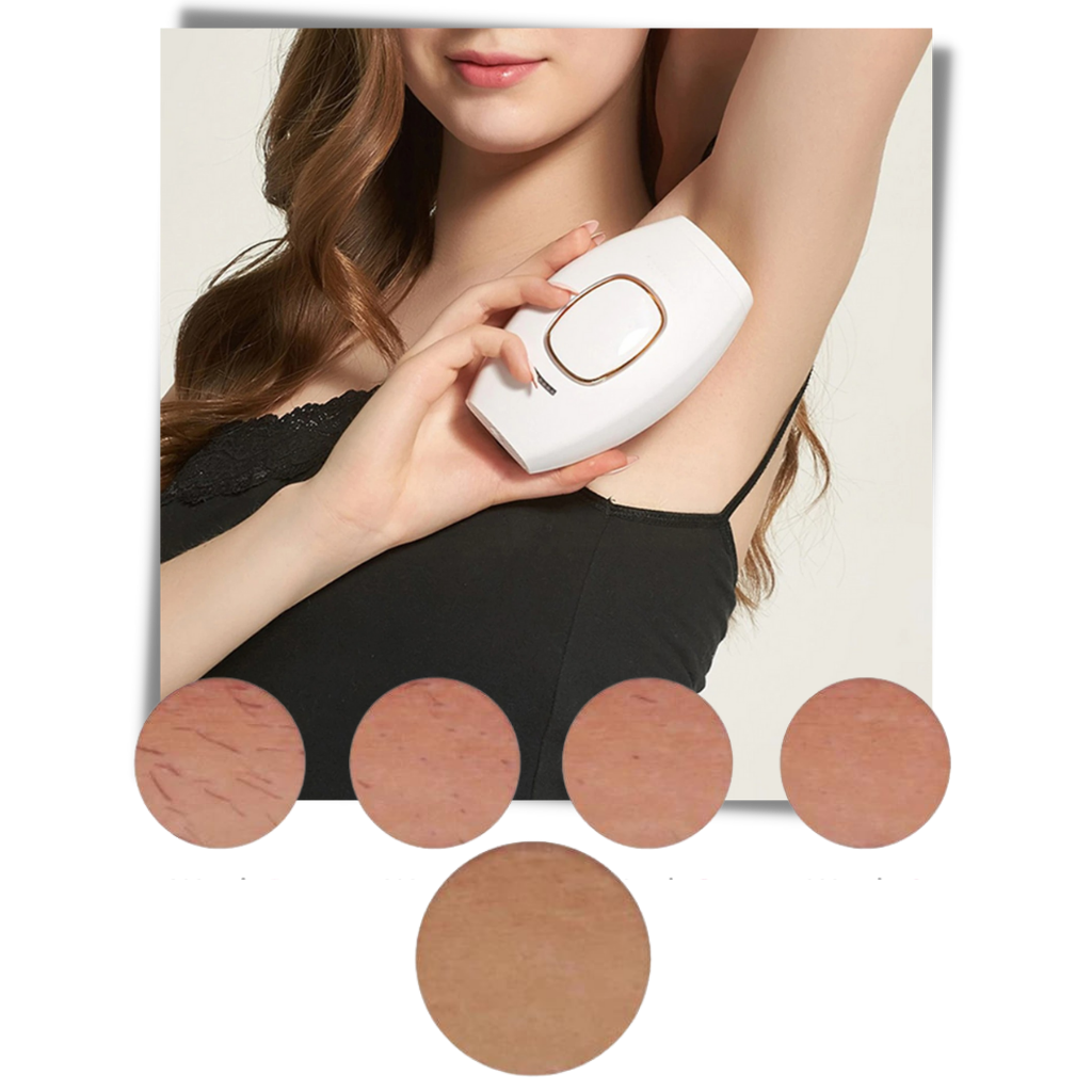 Mini épilateur laser IPL - Ozerty