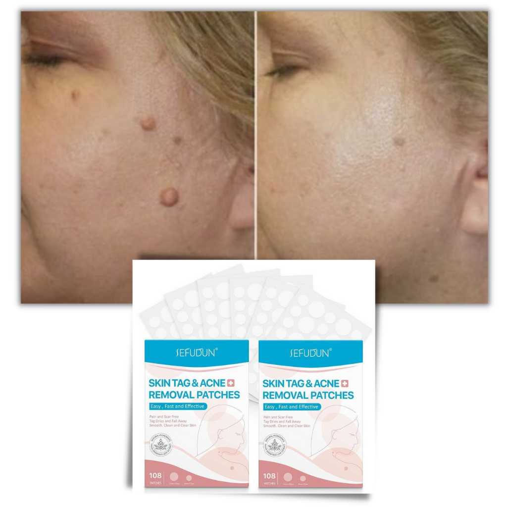 Patch de traitement pour l'élimination des excroissances de peau - Ozerty