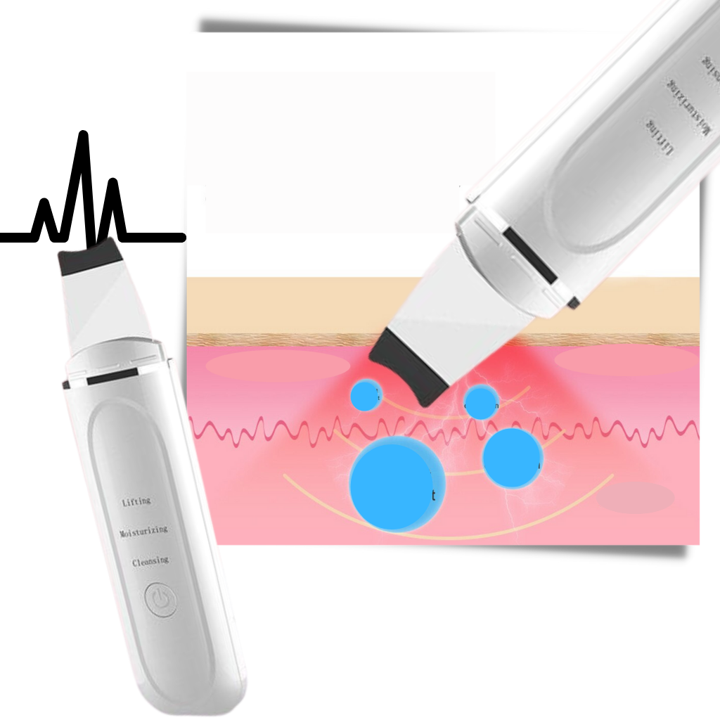 Spatule exfoliante ultrasonique pour le nettoyage en profondeur du visage - Ozerty