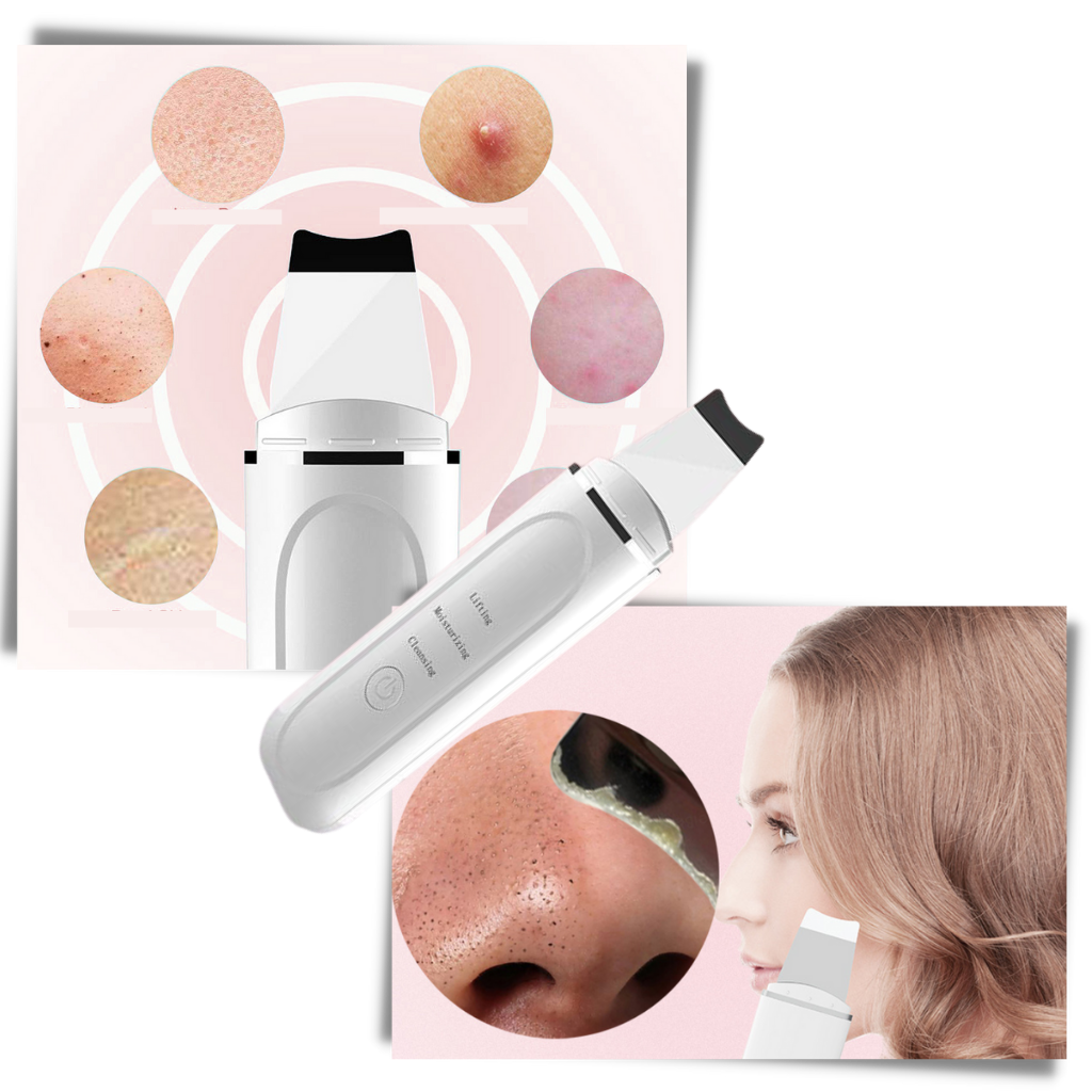 Spatule exfoliante ultrasonique pour le nettoyage en profondeur du visage - Ozerty