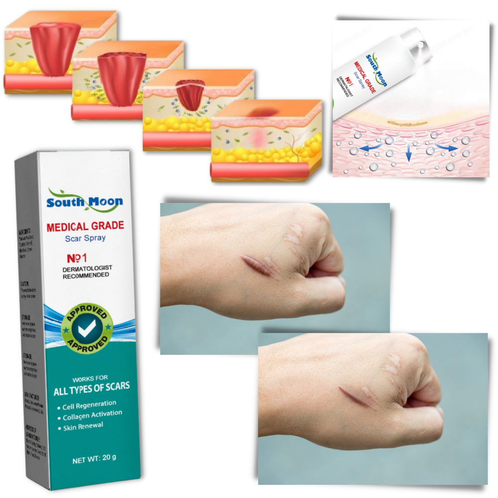 Spray thérapeutique pour l'élimination des cicatrices - Ozerty