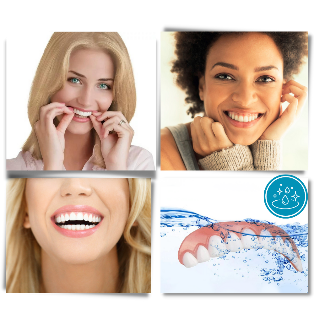 Facettes dentaires à clipser - Ozerty