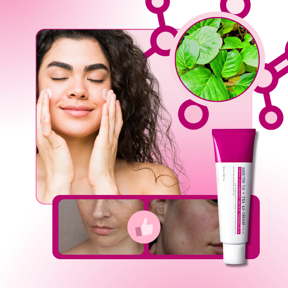 Crème à l'arbutine et à l'acide tranexamique - Ozerty