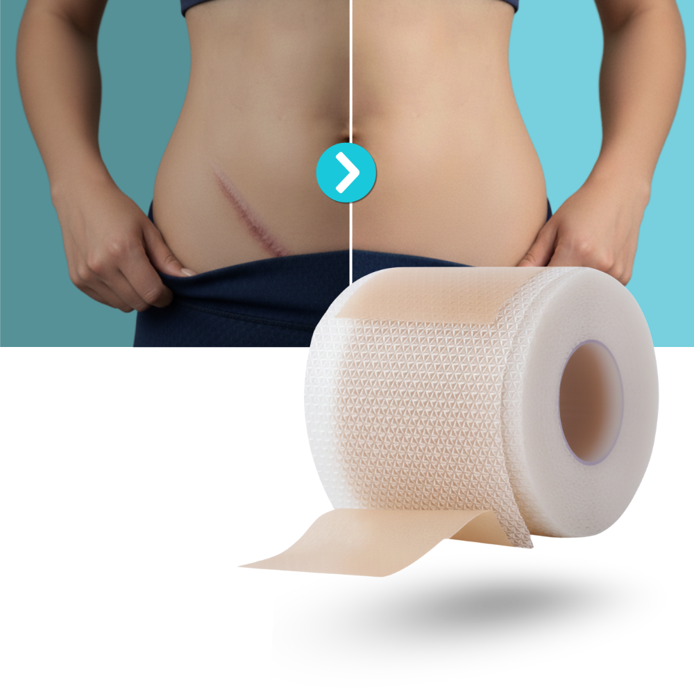 Patch en silicone  à l'acide hyaluronique pour cicatrices - Ozerty