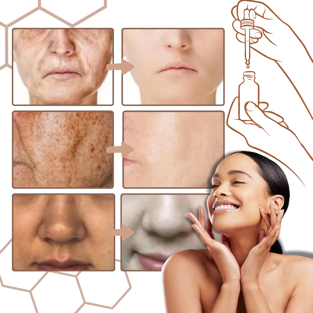 Sérum facial correcteur non gras à la mélanine  - Ozerty