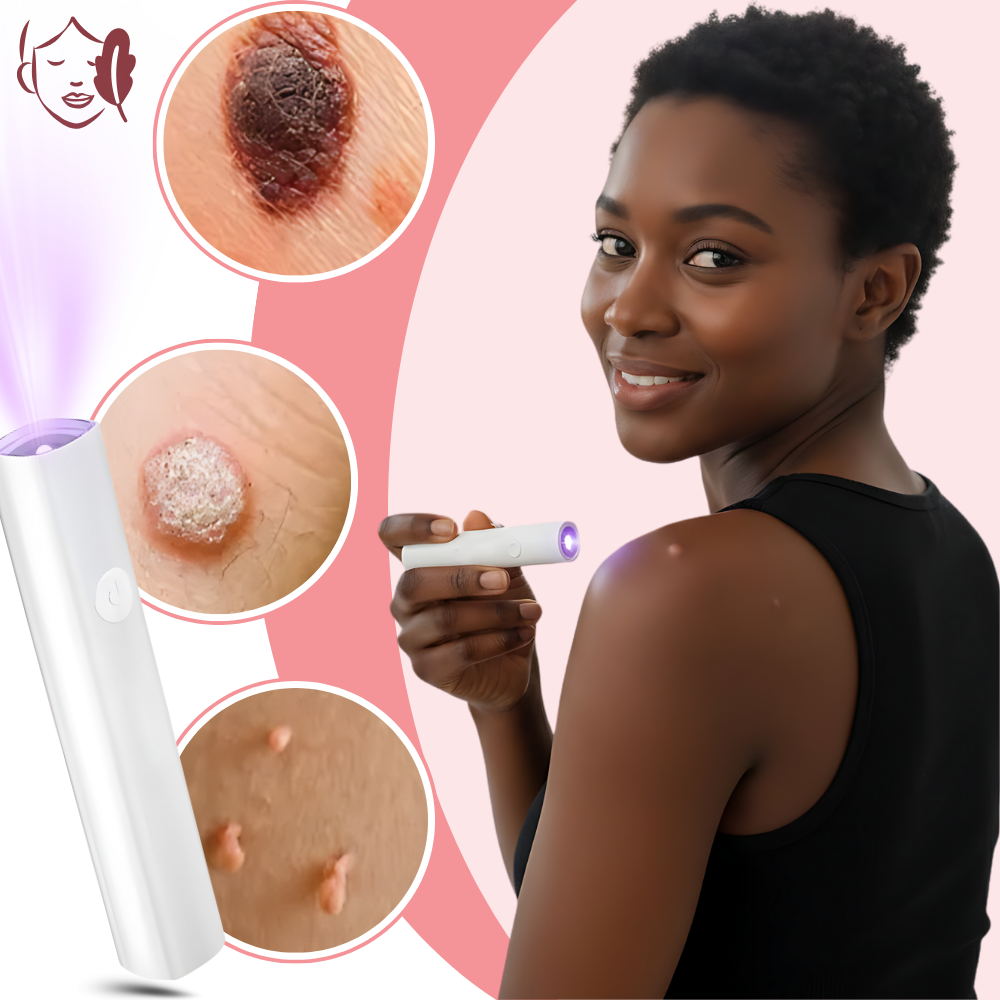Stylo laser cosmétique Radiance - Ozerty