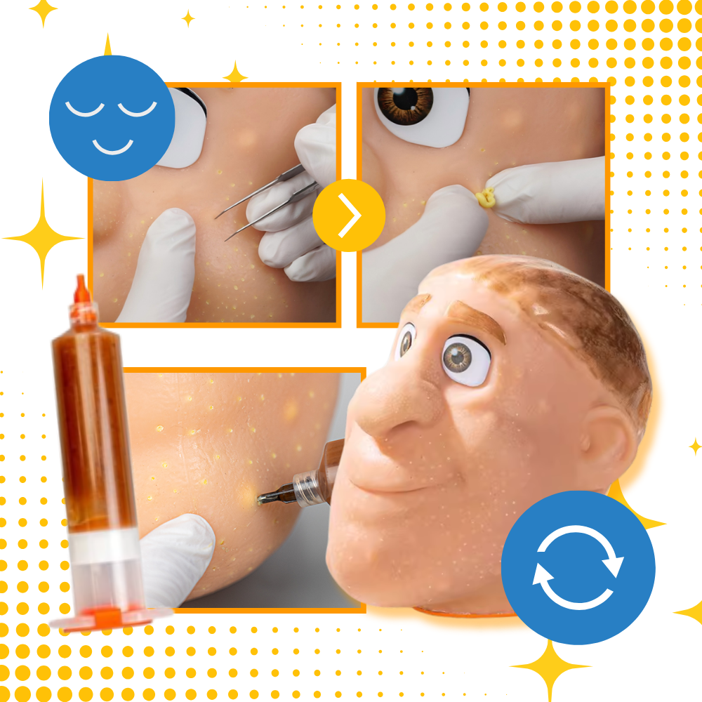 Jeu anti-stress visage en silicone pour percer les boutons - Ozerty