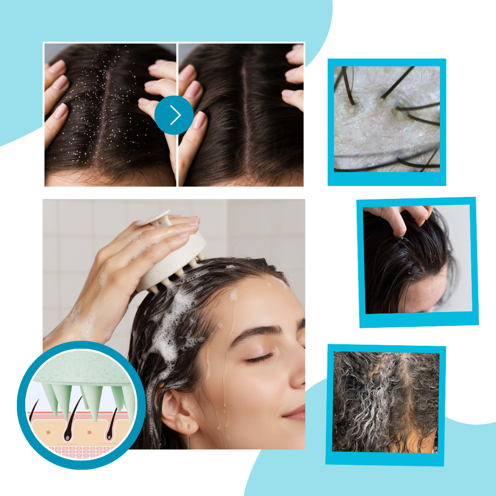 Brosse de massage en silicone pour le cuir chevelu - Ozerty