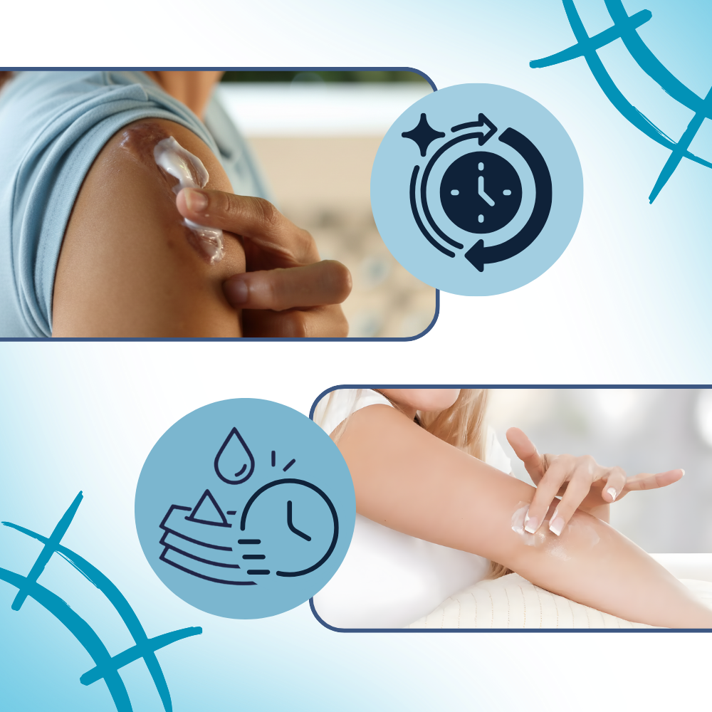 Crème hydratante au silicone pour cicatrices de grossesse - Ozerty