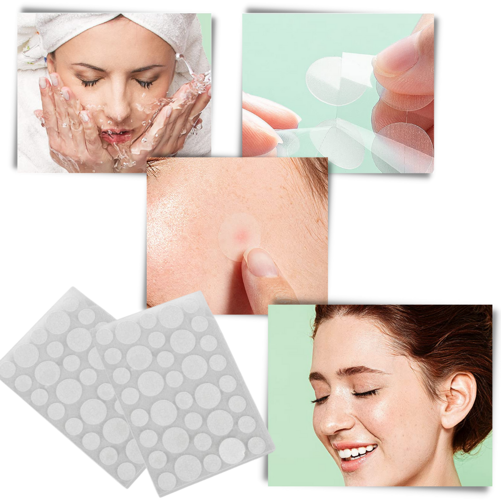 Pack de 36 patchs invisibles contre l'acné - Ozerty