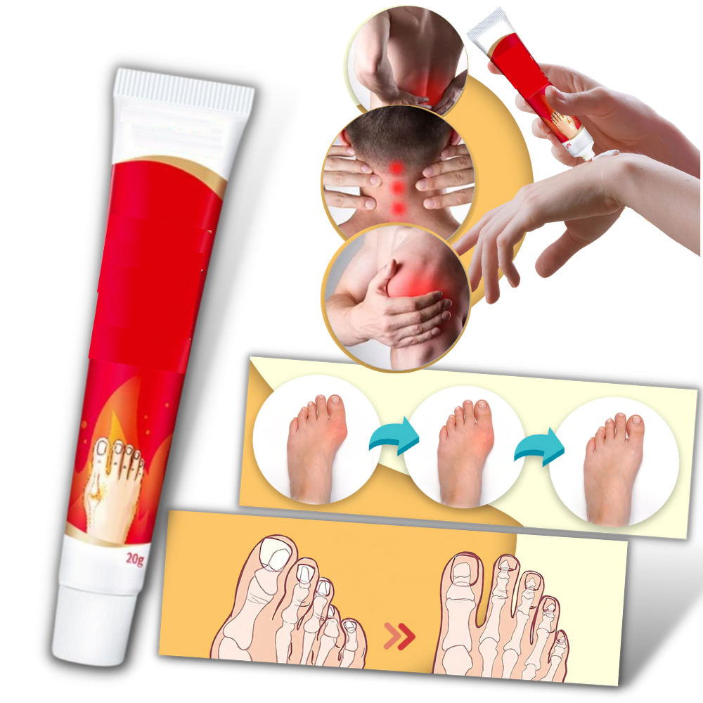 Crème anti-inflammatoire pour oignons du pied - Ozerty
