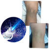 Stylo de thérapie de la peau à la lumière bleue - Ozerty