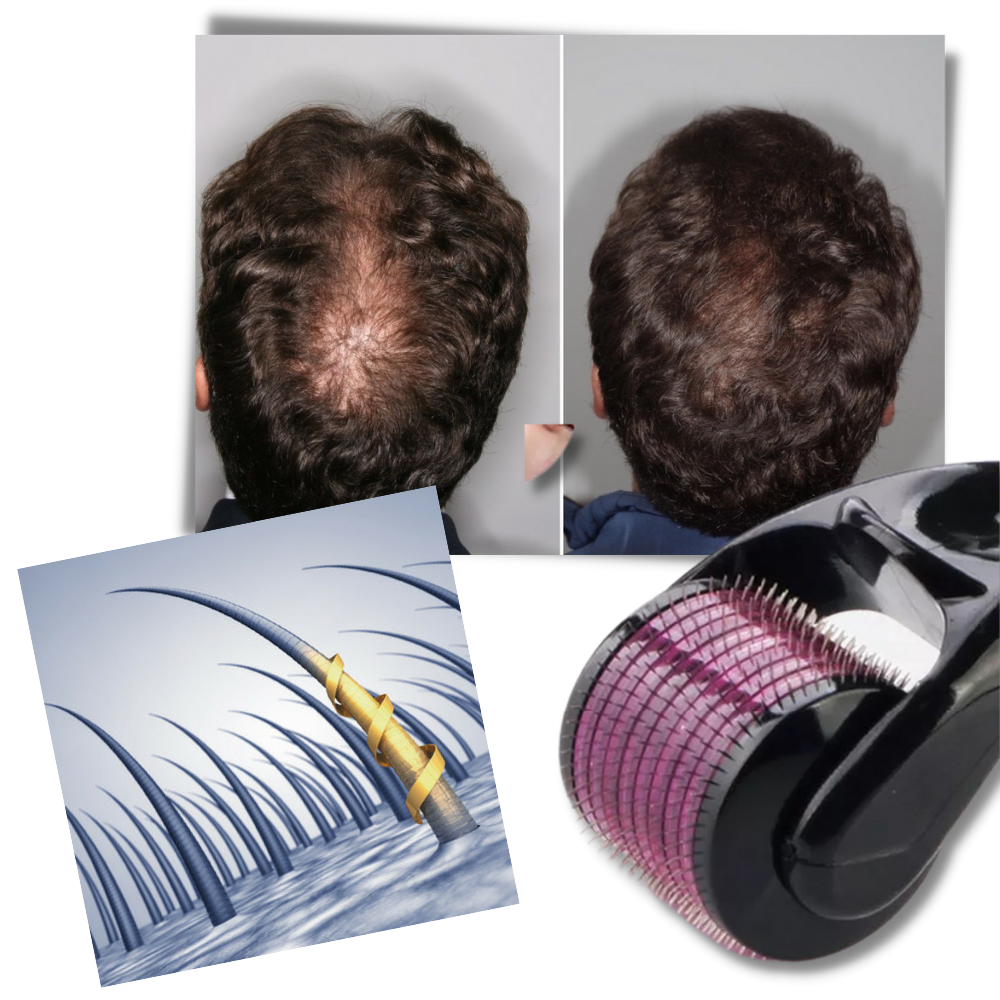 Rouleau dermique pour la croissance des cheveux et de la barbe - Ozerty