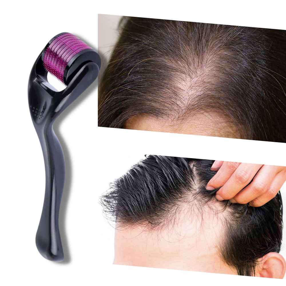 Rouleau dermique pour la croissance des cheveux et de la barbe - Ozerty
