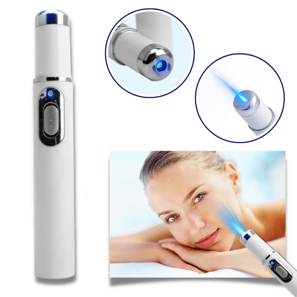 Stylo Laser Anti-acné Et Rides – Traitement Peau, Varices Et Bien-être | ONEVAN